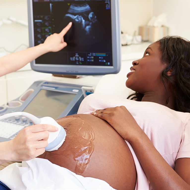 Pregnancy related SCAD