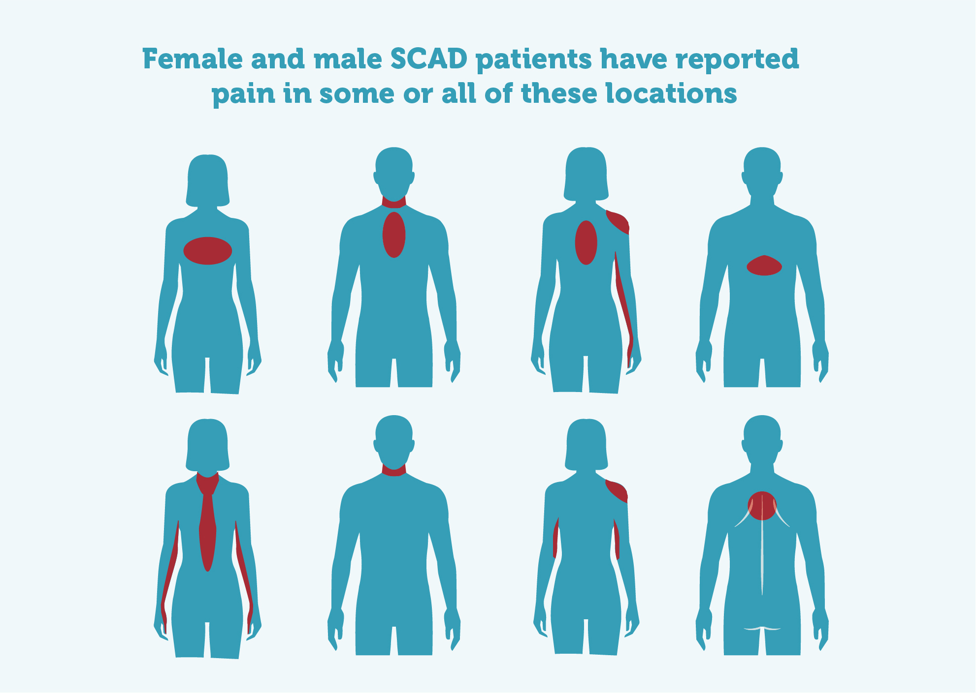 Heart attack pain locations